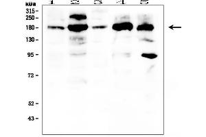 Western blot analysis of PDGFRA using anti- PDGFRA antibody .
