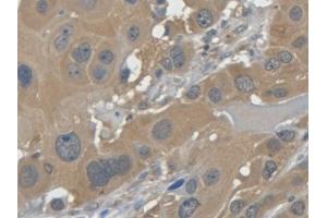 DAB staining on IHC-P; Samples: Human Esophagus (LGALS7 anticorps  (AA 1-136))
