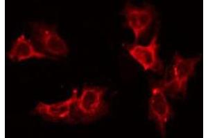 ABIN6275343 staining LOVO by IF/ICC. (DECR2 anticorps  (Internal Region))