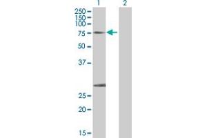 Lane 1: CAPN1 transfected lysate ( 81.