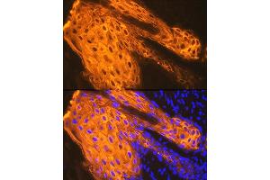 Immunofluorescence analysis of human skin using Cytokeratin 1 (KRT1) (KRT1) Rabbit mAb (ABIN7268085) at dilution of 1:100 (40x lens). (Cytokeratin 1 anticorps)