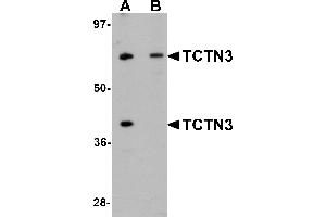 Western Blotting (WB) image for anti-Tectonic Family Member 3 (TCTN3) (C-Term) antibody (ABIN1030726) (TCTN3 anticorps  (C-Term))