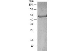 Western Blotting (WB) image for Vimentin (VIM) (AA 2-466) protein (His-IF2DI Tag) (ABIN7125716)