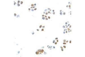 Immunocytochemistry (ICC) image for anti-Mediator Complex Subunit 1 (MED1) (AA 1550-1581) antibody (ABIN7455140) (Recombinant MED1 anticorps  (AA 1550-1581))