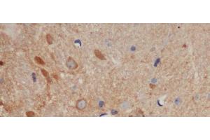 Immunohistochemistry of paraffin-embedded Mouse brain using BCL-x Polyclonal Antibody at dilution of 1:50 (BCL2L1 anticorps)