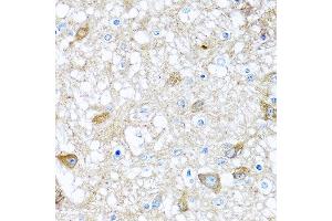 Immunohistochemistry of paraffin-embedded rat brain using BMP5 antibody at dilution of 1:100 (40x lens).