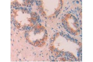 Detection of APOA5 in Human Prostate Gland Tissue using Monoclonal Antibody to Apolipoprotein A5 (APOA5)
