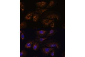 Immunofluorescence analysis of U-2 OS cells using PRSS8 antibody (ABIN7269583) at dilution of 1:100. (PRSS8 anticorps  (C-Term))