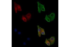 ABIN6256908 and ABIN6275563 staining Hela cells by IF/ICC.