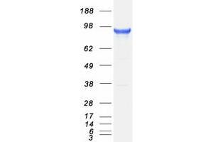 Validation with Western Blot