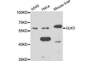 Western blot analysis of extracts of various cell lines, using ULK3 antibody. (ULK3 anticorps)