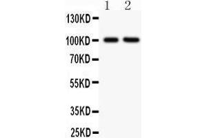 Anti-CD18 Picoband antibody, IHC(P) All lanes: Anti CD18  at 0.