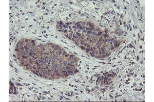 Image no. 5 for anti-Zinc Finger Protein 365 (ZNF365) (AA 108-407) antibody (ABIN1490829)