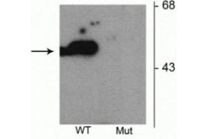 Western blot of HEK293 cells transfected with Parkin wild type (WT) and Parkin S101 mutant (Mut) showing the specific immunolabeling of the ~52 kDa parkin protein phosphorylated at Ser101. (Parkin anticorps  (pSer101))