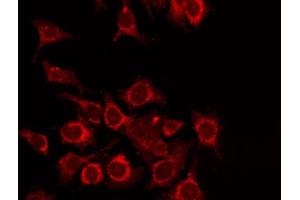 ABIN6268762 staining Hela by IF/ICC. (TDG anticorps  (Internal Region))