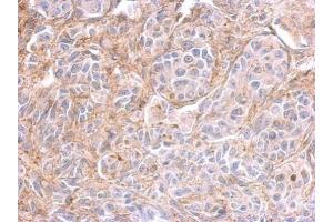 anti-Liprin-beta-2 (PPFIBP2) (Center) antibody