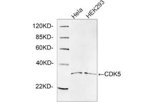 Western blot analysis of cell lysates using 1 µg/mL Rabbit Anti-CDK5 Polyclonal Antibody (ABIN398921) The signal was developed with IRDyeTM 800 Conjugated Goat Anti-Rabbit IgG. (CDK5 anticorps  (C-Term))