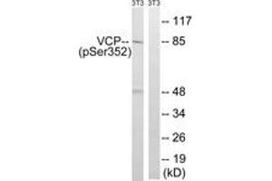 Western blot analysis of extracts from NIH-3T3 cells treated with starved 24h, using VCP (Phospho-Ser352) Antibody. (VCP anticorps  (pSer352))