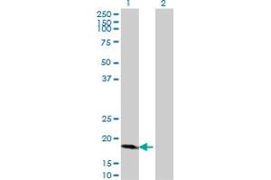 Western Blot analysis of CDKN2D expression in transfected 293T cell line by CDKN2D monoclonal antibody (M08), clone 2E10.