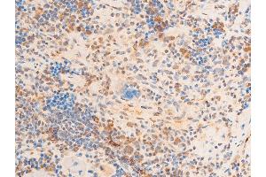 ABIN6267273 at 1/100 staining rat spleen tissue sections by IHC-P.