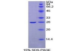 SDS-PAGE analysis of Rat Complement Receptor 2 Protein. (CD21 Protéine)