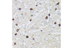 Immunohistochemistry of paraffin-embedded rat brain using MIP antibody at dilution of 1:100 (x40 lens). (MIP anticorps)