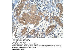 Rabbit Anti-ACP1 Antibody  Paraffin Embedded Tissue: Human Kidney Cellular Data: Epithelial cells of renal tubule Antibody Concentration: 4. (ACP1 anticorps  (N-Term))