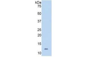 WB of Protein Standard: different control antibodies  against Highly purified E. (CD31 Kit ELISA)