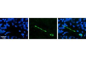 Rabbit Anti-MTUS1 Antibody     Formalin Fixed Paraffin Embedded Tissue: Human Pineal Tissue  Observed Staining: Cytoplasmic and membrane in cell bodies of pinealocytes and their processes  Primary Antibody Concentration: 1:100  Other Working Concentrations: 1/600  Secondary Antibody: Donkey anti-Rabbit-Cy3  Secondary Antibody Concentration: 1:200  Magnification: 20X  Exposure Time: 0.