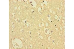 Immunohistochemistry of paraffin-embedded human brain tissue using ABIN7148784 at dilution of 1:100 (CXXC5 anticorps  (AA 1-227))