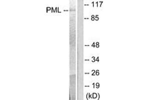 Western blot analysis of extracts from A549 cells, using PML Antibody. (PML anticorps  (AA 11-60))