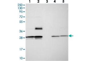 Western blot analysis of Lane 1: RT-4, Lane 2: U-251 MG, Lane 3: Human Plasma, Lane 4: Liver, Lane 5: Tonsil with MXRA7 polyclonal antibody  at 1:250-1:500 dilution. (MXRA7 anticorps)