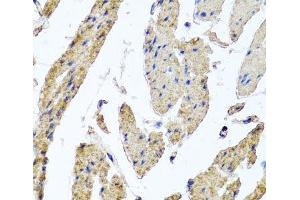 Immunohistochemistry of paraffin-embedded Human esophageal smooth muscle using MRPL12 Polyclonal Antibody at dilution of 1:100 (40x lens).