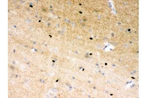 Anti- PARP Picoband antibody, IHC(P) IHC(P): Rat Brain Tissue