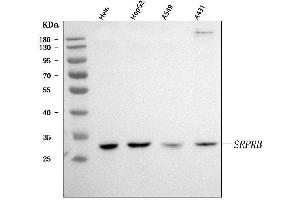 Western blot analysis of SRPRB using anti-SRPRB antibody (ABIN7602015).