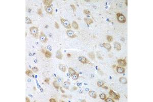 Immunohistochemistry of paraffin-embedded mouse brain using GFM1 antibody at dilution of 1:100 (40x lens). (GFM1 anticorps)