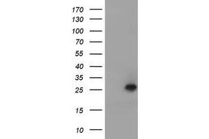 Image no. 1 for anti-Ubiquitin-Conjugating Enzyme E2E 3 (UBE2E3) antibody (ABIN1501619) (UBE2E3 anticorps)