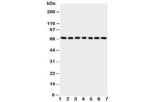 Western blot testing of NOX4 antibody and Lane 1:  rat kidney (NADPH Oxidase 4 anticorps  (C-Term))