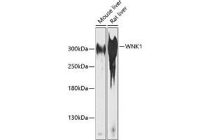 Western blot analysis of extracts of various cell lines, using WNK1 antibody  at 1:1000 dilution. (WNK1 anticorps  (AA 1-210))