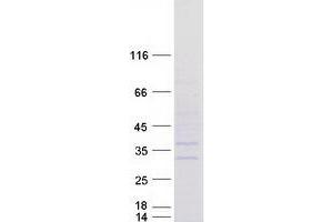 Validation with Western Blot