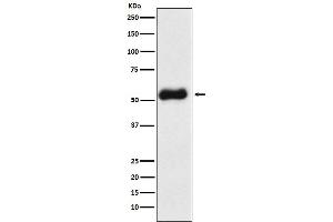 Western blot analysis of Thromboxane synthase expression in Human fetal liver lysate.