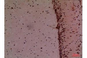 Immunohistochemistry (IHC) analysis of paraffin-embedded Mouse Brain, antibody was diluted at 1:100.
