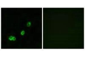 Immunofluorescence analysis of MCF-7 cells, using ACOT1 antibody. (ACOT1 anticorps)
