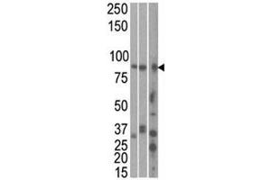The MARK1 antibody used in western blot to detect MARK1 in HeLa, T47D, and mouse brain cell line/ tissue lysate (left to right)