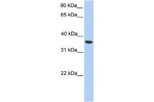Western Blotting (WB) image for anti-Melanoma Antigen Family A, 4 (MAGEA4) antibody (ABIN2459747) (MAGEA4 anticorps)