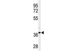 Western blot analysis of SIRT3 antibody and CHO lysate