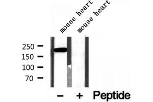 Western blot analysis of extracts of mouse heart tissue, using MYH7-specific antibody.