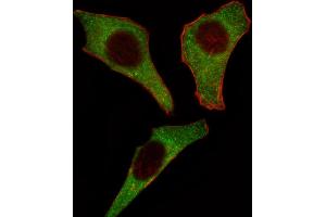 Fluorescent image of Hela cell stained with CDK4 Antibody (C-term) (ABIN391751 and ABIN2841625). (CDK4 anticorps  (C-Term))