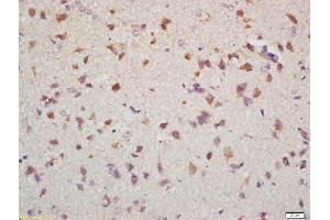 Formalin-fixed and paraffin embedded mouse brain labeled with Anti-NET1 Polyclonal Antibody, Unconjugated (ABIN1714215) at 1:200 followed by conjugation to the secondary antibody and DAB staining (NET1 anticorps)