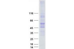 Validation with Western Blot